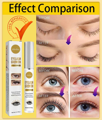 MC-012-UU】Fast Eyelash Growth Serum Lifting Eyelashes Eyebrows Enhancer Eyelash Lengthening Fuller Thicker Eyelash Growth Products